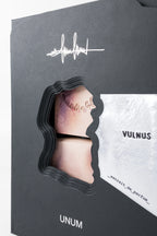 VULNUS